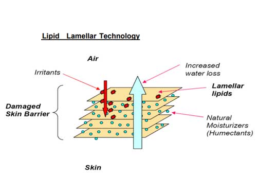 lipid lamellar technology
